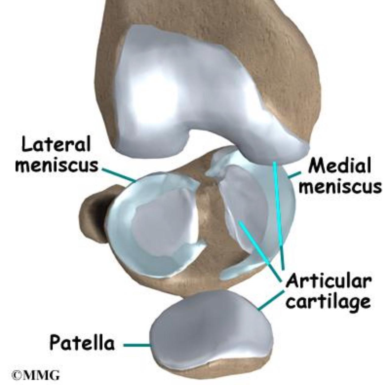 Meniscus surgery and knee arthroscopy in Bangalore